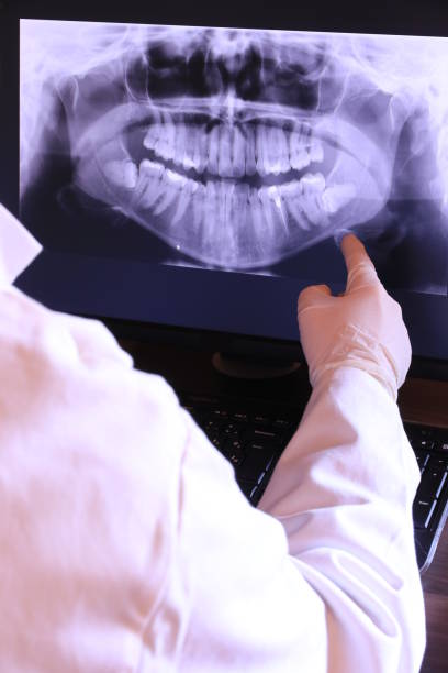 Best Emergency Tooth Extraction in Rolla, ND