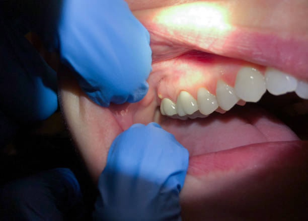 Professional Emergency Dentist in ND